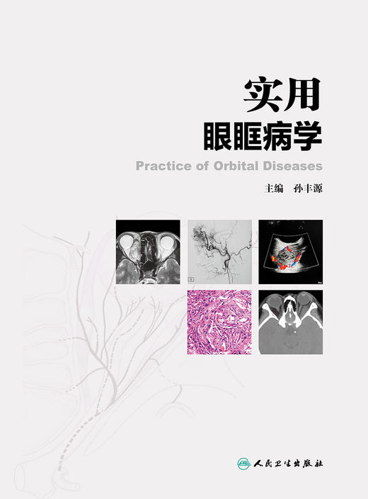 实用眼眶病学 提高临床诊疗水平 眼眶病的病理学基础 眼科学书籍 眼球筋膜炎 孙丰源 主编 9787117314268 人民卫生出版社 商品图2
