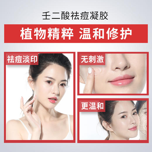 【德德维芙 抗痘修护 拍二发三 拍三发五！！！】15%壬二酸凝胶质润祛痘膏祛黑头去痘印修复凹洞痘坑神器除青春痘 商品图4
