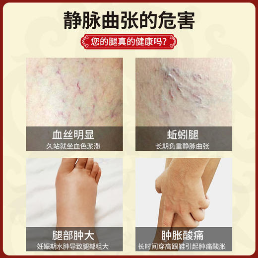 爆款预售！8.25发货【告别蚯蚓腿】同仁堂脉乐舒凝胶静脉曲张肿胀酸痛青筋凸起腿部肿大静脉曲张膏20g/支 商品图1