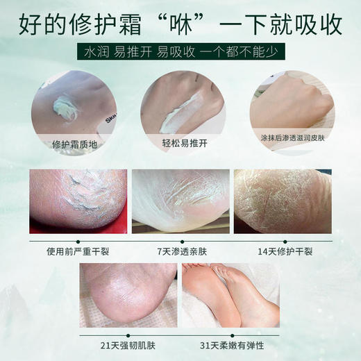 【大促：送护手霜去黑头水瑞典进口乳木果油，手脚干裂修复】SKINCLINIK乳木果手足皴裂修复霜 商品图6