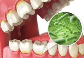 口气难闻太尴尬？学习这几招，让你外出做清新女孩！