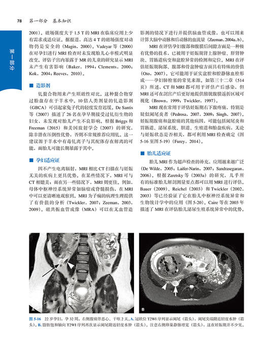 坎-吉产科手术学 第3版 赵扬玉 妇产科外科手术书籍 产科临床超声图磁共振图像实物照片显微照片 北京大学医学出版社9787565924163 商品图4