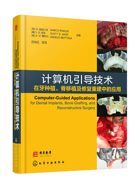 计算机引导技术在牙种植、骨移植及修复重建中的应用