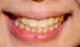  20年口臭居然是因为这个东西！含一颗，瞬间消灭它！一整天口吐芬芳！ 