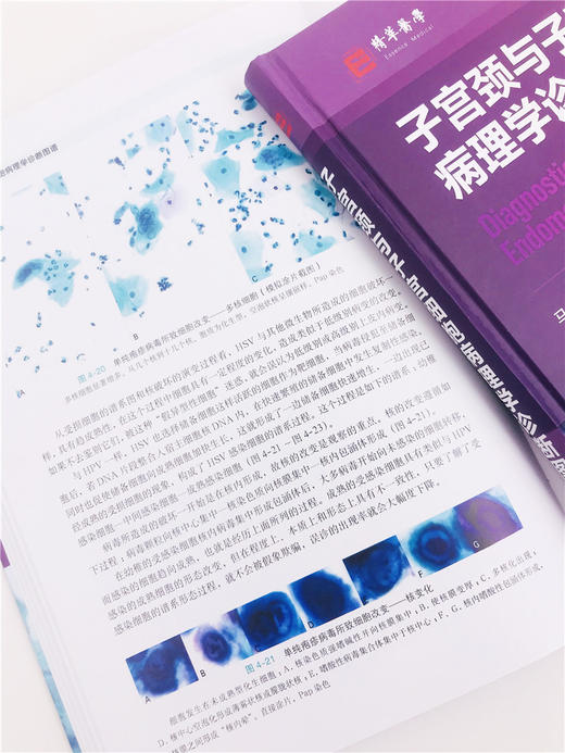 医学精萃系列 子宫颈与子宫细胞病理学诊断图谱 商品图3