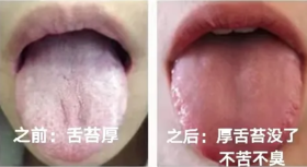  吴昕再曝祛湿“法宝”，每天一杯，身体轻松，养好脾胃 