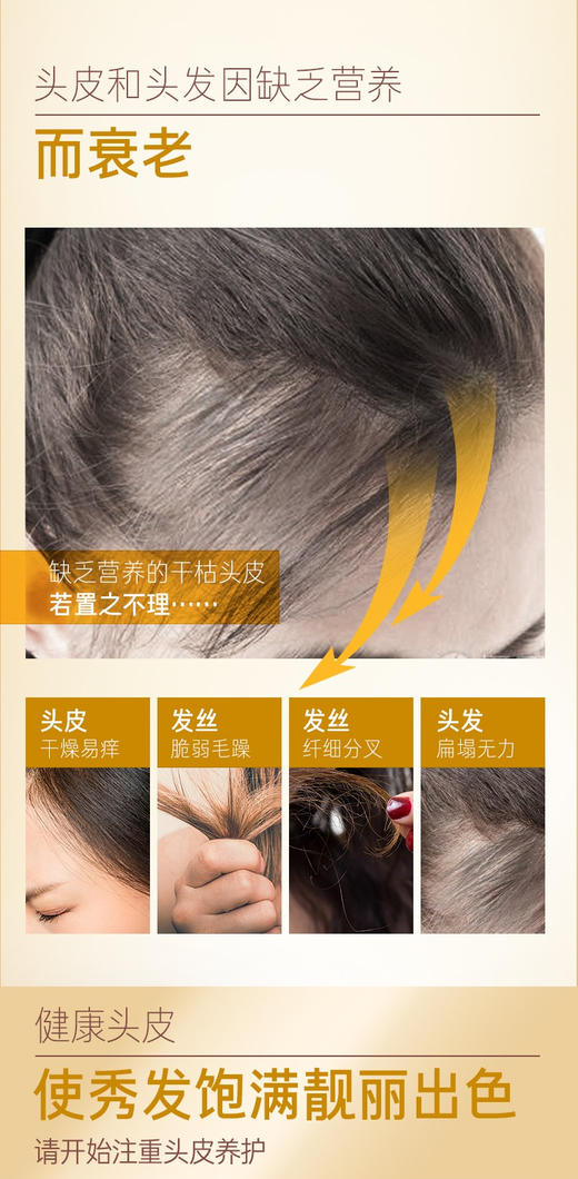 【中欧班列精选】XDR黑吕控油去屑止痒洗头膏固发柔顺护发素400ml 商品图1