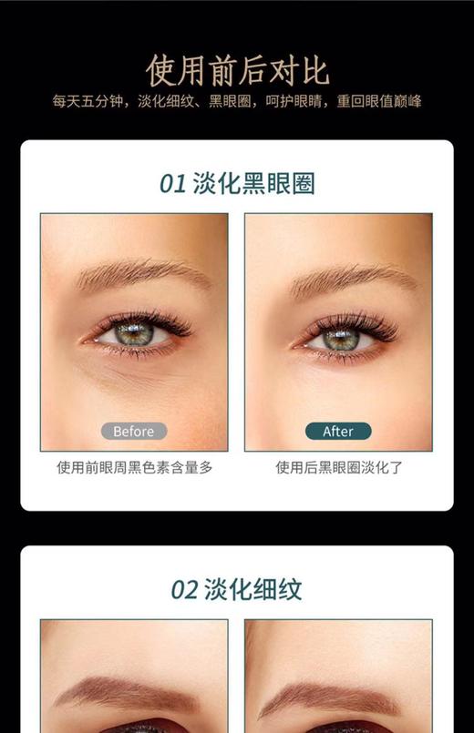 红砭石眼部按摩仪器眼霜导入美眼棒护眼睛眼袋皱纹黑眼圈热敷去神器 商品图9