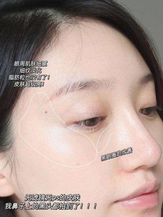 Clarins/娇韵诗双萃眼部精华20ml 眼霜 淡细纹黑眼圈焕亮双眼平滑纹路 商品图10