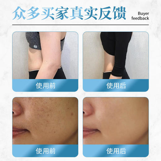 【买3送2】御恒堂清清灸灸出湿气消除浮肿气色佳睡眠好一身轻松18贴/盒 商品图5