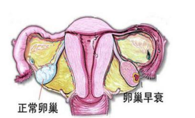 警惕！加速卵巢早衰的6大高危因素 