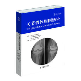 关节假体周围感染   主译：刘培来 李德强 卢群山  山科出版