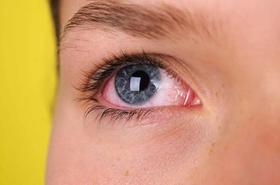  疲劳双眼、每天15分钟，视力好，眼袋消，眼睛更有神！ 