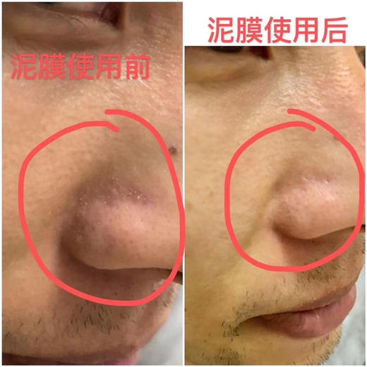 MMT uau大麻舒缓泥膜100g 商品图2