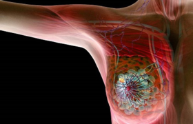  科普 | 放疗常见的几大副作用，这样护理就对了！ 