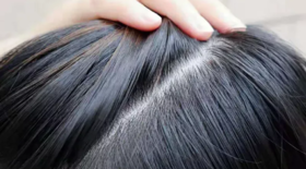  育发界的劳斯莱斯！全网卖到手软？我秃成地中海照样能用！ 