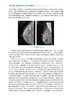 组织标记在乳腺疾病精准诊疗中的应用 包含了影像学组织标记在乳腺疾病中的筛查 刘强 龚畅 主编9787117317306人民卫生出版社 商品缩略图4