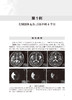 北京协和医院神经科疑难罕见病例解析 图文并茂 较完整地展示病例诊治的过程 崔丽英 彭斌 主编 9787117318907人民卫生出版社 商品缩略图4