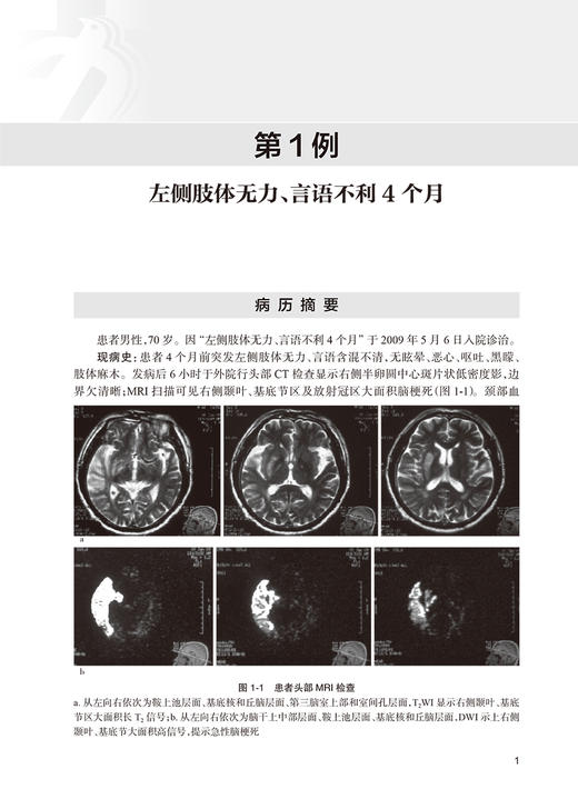 北京协和医院神经科疑难罕见病例解析 图文并茂 较完整地展示病例诊治的过程 崔丽英 彭斌 主编 9787117318907人民卫生出版社 商品图4