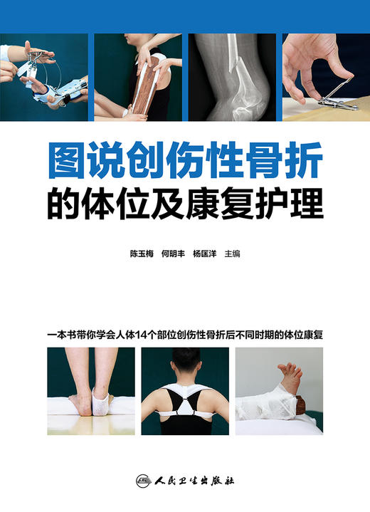 图说创伤性骨折的体位及康复护理 分步骤地解析了骨折后院前急救体位的要求和标准 陈玉梅 主编 9787117316248人民卫生出版社 商品图2
