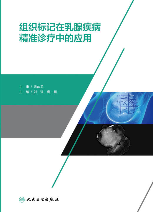 组织标记在乳腺疾病精准诊疗中的应用 包含了影像学组织标记在乳腺疾病中的筛查 刘强 龚畅 主编9787117317306人民卫生出版社 商品图2