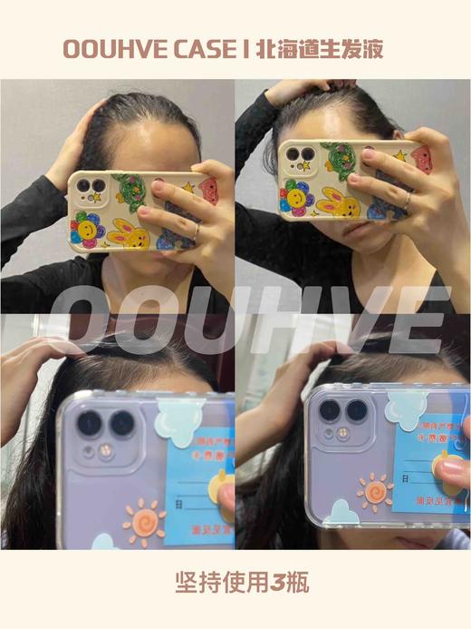 5折清仓(8月到期，不开封可延长2年)头皮抗老产后脱发拯救发际线日进口北海道生发液头皮护理精华增长睫毛眉毛20ml 商品图5