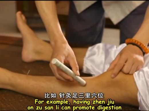 30 Acupuncture and Moxibustion TCM 商品图0