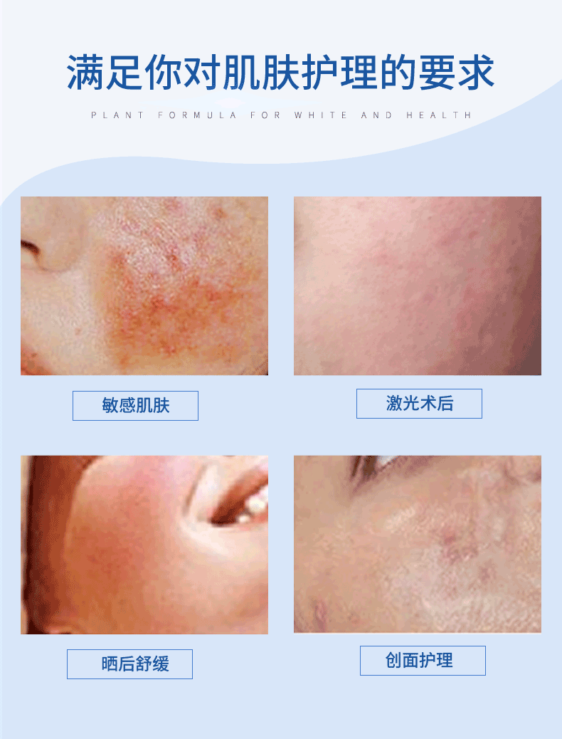 昕雅莎医用保湿修护面膜5片装白色包装敏感肌肤干燥性肌肤果酸激光术