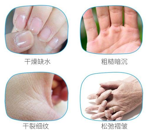 【3支58】正品！润培roopy护手霜，每支75ml 商品图5