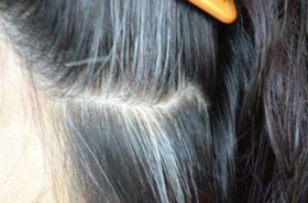 头发变白！原来是这里出了毛病，让你的白发黑回去！ 