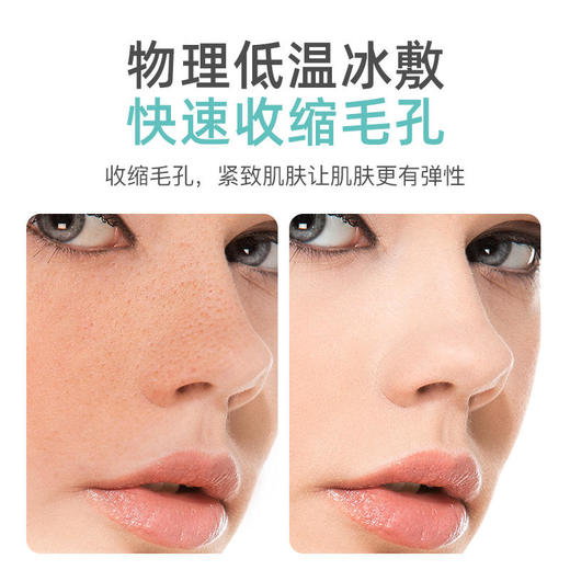 【肌肤冻龄】IMATE冰敷仪弹性肌肤消除浮肿收缩毛孔不伤肌肤 商品图2