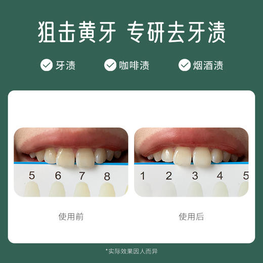 【韩国原装进口】麦斯特凯斯乳香牙膏  清新口气、美白牙齿、湿润口腔 商品图7