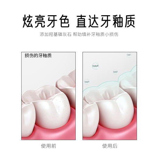 【韩国原装进口】麦斯特凯斯乳香牙膏  清新口气、美白牙齿、湿润口腔 商品图6