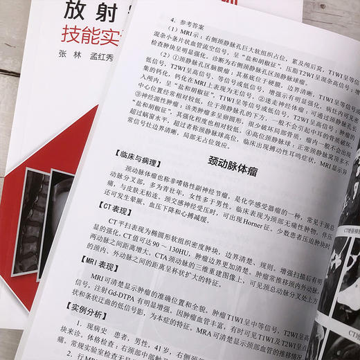 住院医师规范化培训放射影像技能实训宝典 商品图7