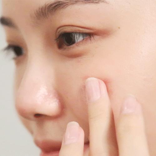 菜鸟和配方师·祛痘凝胶 , 名校博士研发，专利技术祛痘，呵护不留印 商品图2