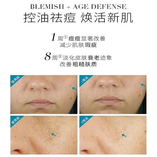 修丽可多果酸酸/焕活复颜精华液30ml 商品图3