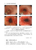 消化内镜治疗学典型病例图谱 陈磊 等编 超声影像医学书籍超声内镜消化系统疾病诊断和治疗 科学技术文献出版社9787518980208 商品缩略图2