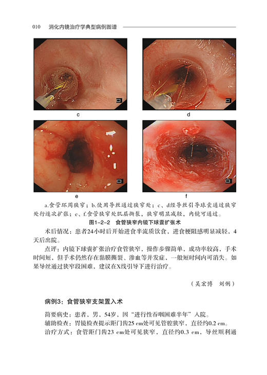 消化内镜治疗学典型病例图谱 陈磊 等编 超声影像医学书籍超声内镜消化系统疾病诊断和治疗 科学技术文献出版社9787518980208 商品图2