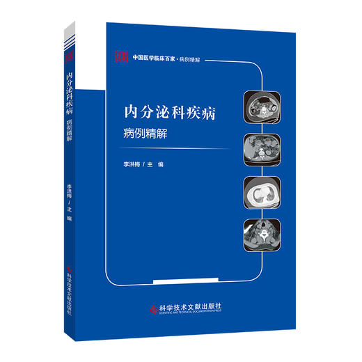 内分泌科疾病病例精解 中国医学临床百家·病例精解 多囊肾合并顽固性高血压 李洪梅 主编 9787518982257 科学技术文献出版社 商品图1