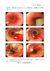 消化内镜治疗学典型病例图谱 陈磊 等编 超声影像医学书籍超声内镜消化系统疾病诊断和治疗 科学技术文献出版社9787518980208 商品缩略图3