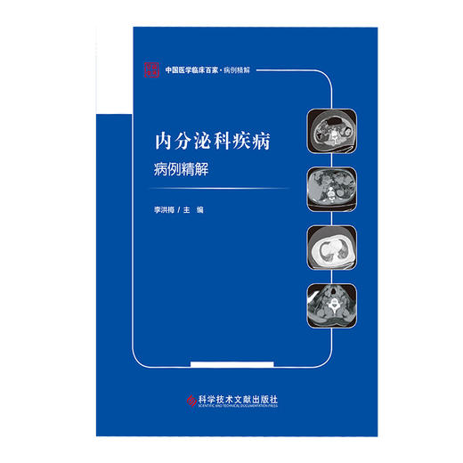 内分泌科疾病病例精解 中国医学临床百家·病例精解 多囊肾合并顽固性高血压 李洪梅 主编 9787518982257 科学技术文献出版社 商品图3