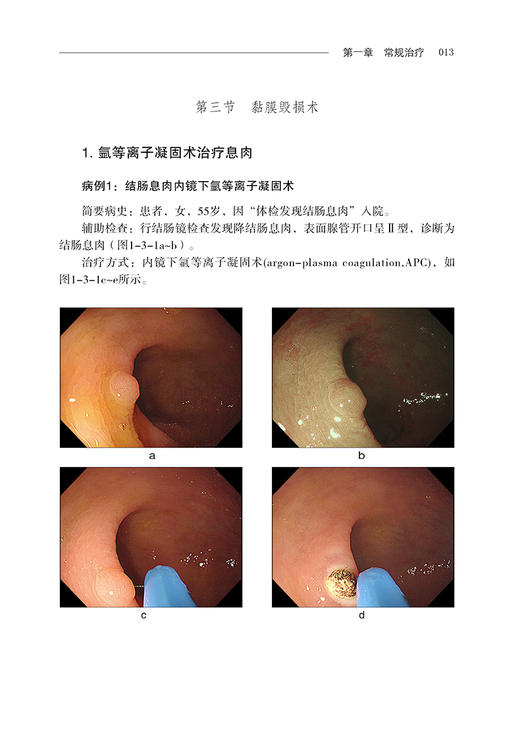 消化内镜治疗学典型病例图谱 陈磊 等编 超声影像医学书籍超声内镜消化系统疾病诊断和治疗 科学技术文献出版社9787518980208 商品图4