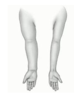  简单易学！对抗乳腺癌术后淋巴水肿，这些方法强烈推荐！ 