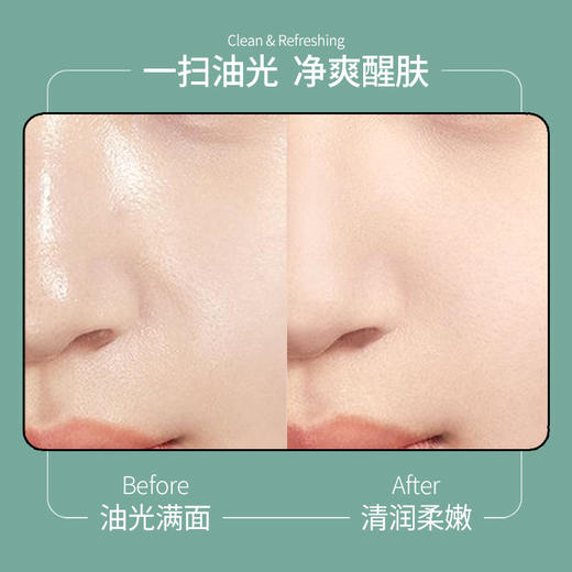 【脸部专利除螨买一送一】山茶花氨基酸洁面泡泡告别暗黄除螨率高达99.63%美白提亮控油祛痘去除黑头净化毛孔敏感肌适用烟酰胺洗面奶洁面慕斯150ml/瓶 商品图7