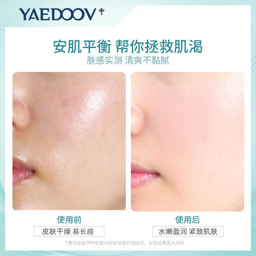 英国雅伯顿益生元酵母盈润清透隐形面膜院线专用舒缓补水保湿紧致修护亮白10片/盒 商品图5