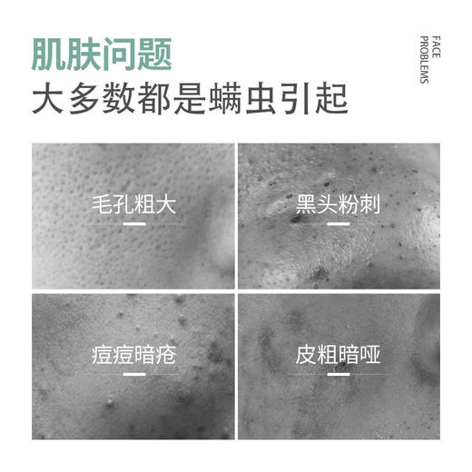 【脸部专利除螨买一送一】山茶花氨基酸洁面泡泡告别暗黄除螨率高达99.63%美白提亮控油祛痘去除黑头净化毛孔敏感肌适用烟酰胺洗面奶洁面慕斯150ml/瓶 商品图1