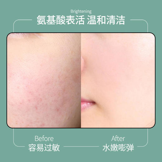 【脸部专利除螨买一送一】山茶花氨基酸洁面泡泡告别暗黄除螨率高达99.63%美白提亮控油祛痘去除黑头净化毛孔敏感肌适用烟酰胺洗面奶洁面慕斯150ml/瓶 商品图6