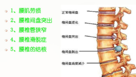 怎么告别现代人的“头号公敌”——脊椎病？ 