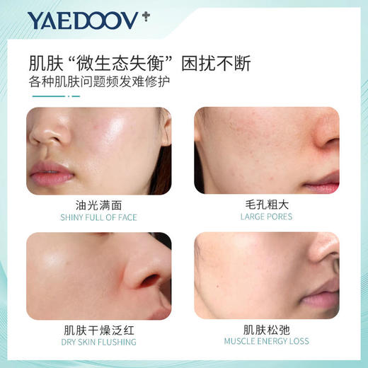 英国雅伯顿益生元酵母盈润清透隐形面膜院线专用舒缓补水保湿紧致修护亮白10片/盒 商品图1