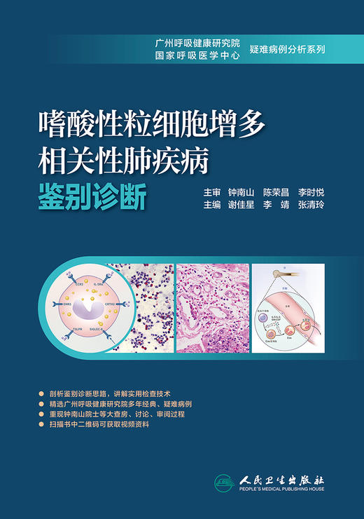 嗜酸性粒细胞增多相关性肺疾病鉴别诊断 商品图1